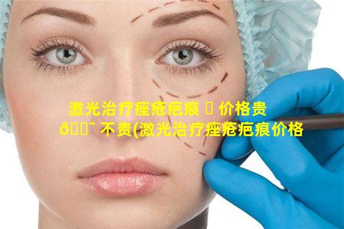 激光治疗痤疮疤痕 ☘ 价格贵 🐯 不贵(激光治疗痤疮疤痕价格贵不贵呢)